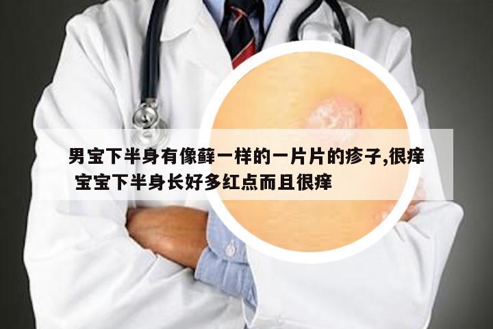 男宝下半身有像藓一样的一片片的疹子,很痒 宝宝下半身长好多红点而且很痒