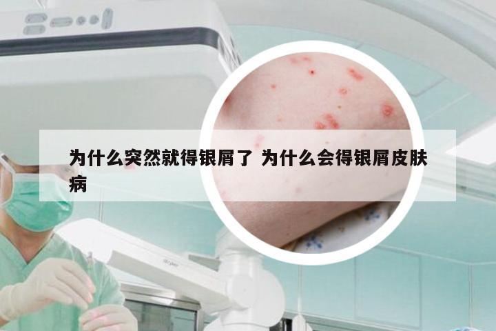 为什么突然就得银屑了 为什么会得银屑皮肤病