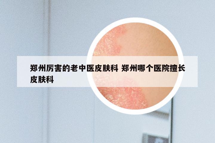 郑州厉害的老中医皮肤科 郑州哪个医院擅长皮肤科