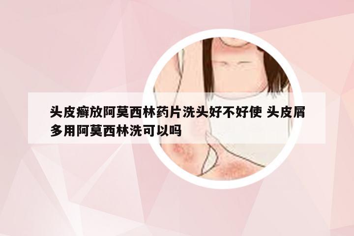 头皮癣放阿莫西林药片洗头好不好使 头皮屑多用阿莫西林洗可以吗