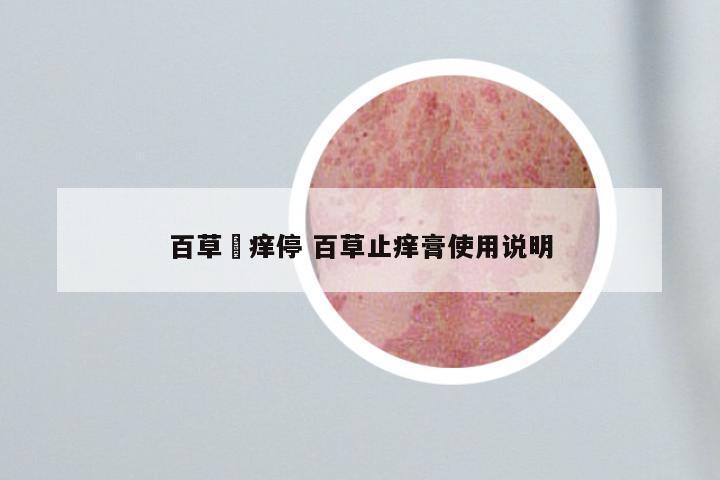 百草廯痒停 百草止痒膏使用说明