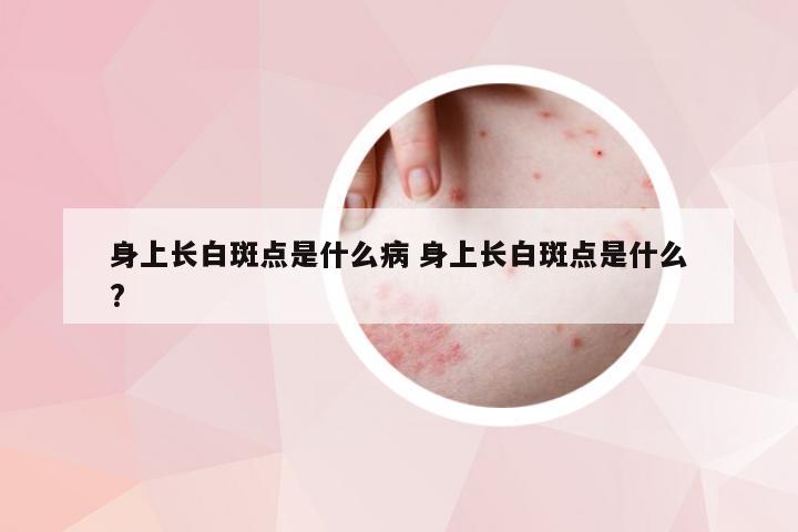 身上长白斑点是什么病 身上长白斑点是什么?