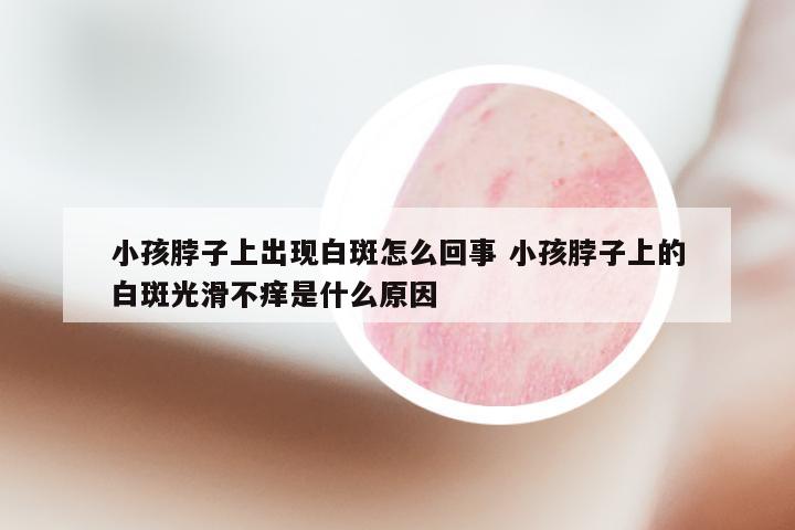 小孩脖子上出现白斑怎么回事 小孩脖子上的白斑光滑不痒是什么原因