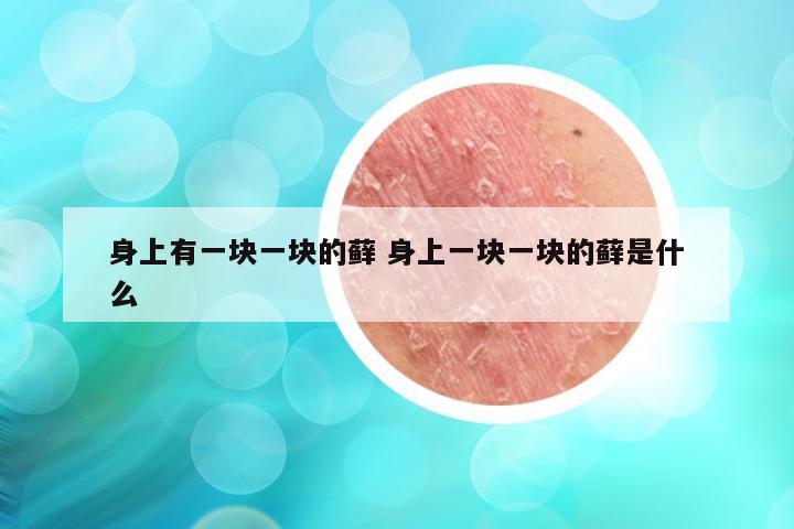 身上有一块一块的藓 身上一块一块的藓是什么