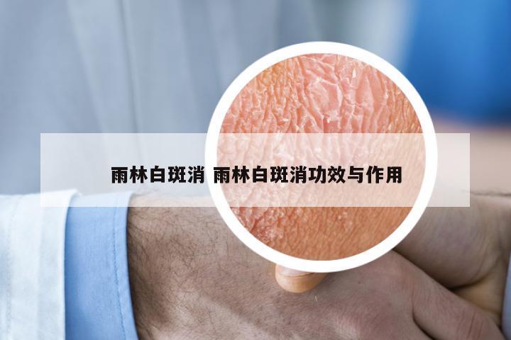 雨林白斑消 雨林白斑消功效与作用