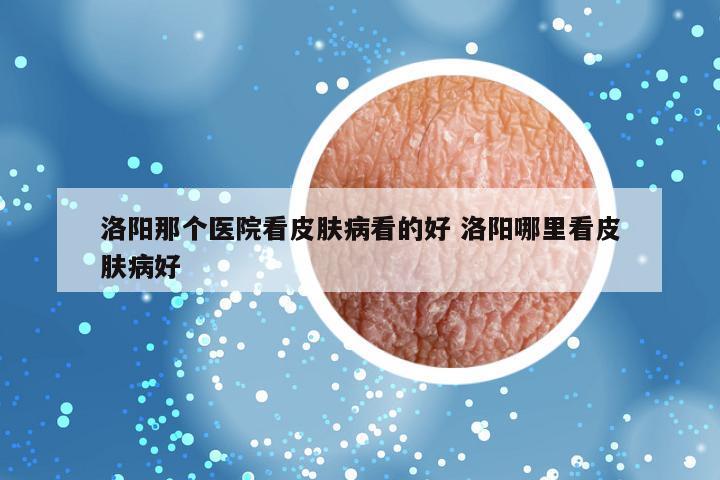 洛阳那个医院看皮肤病看的好 洛阳哪里看皮肤病好