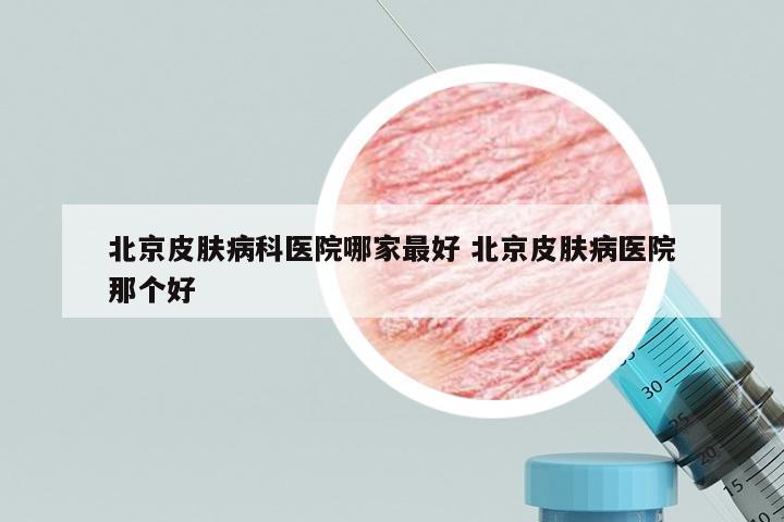 北京皮肤病科医院哪家最好 北京皮肤病医院那个好