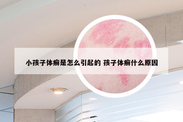 小孩子体癣是怎么引起的 孩子体癣什么原因