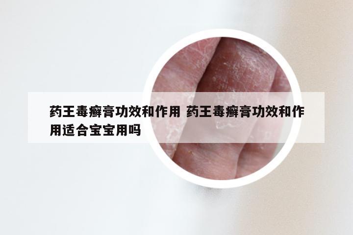 药王毒癣膏功效和作用 药王毒癣膏功效和作用适合宝宝用吗