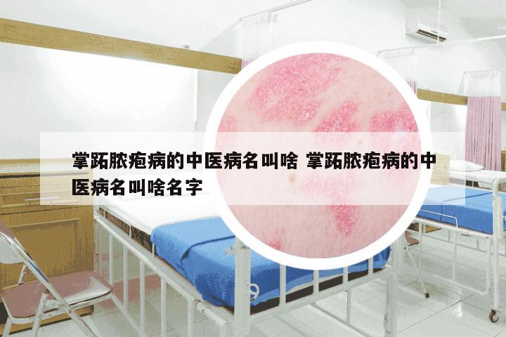 掌跖脓疱病的中医病名叫啥 掌跖脓疱病的中医病名叫啥名字