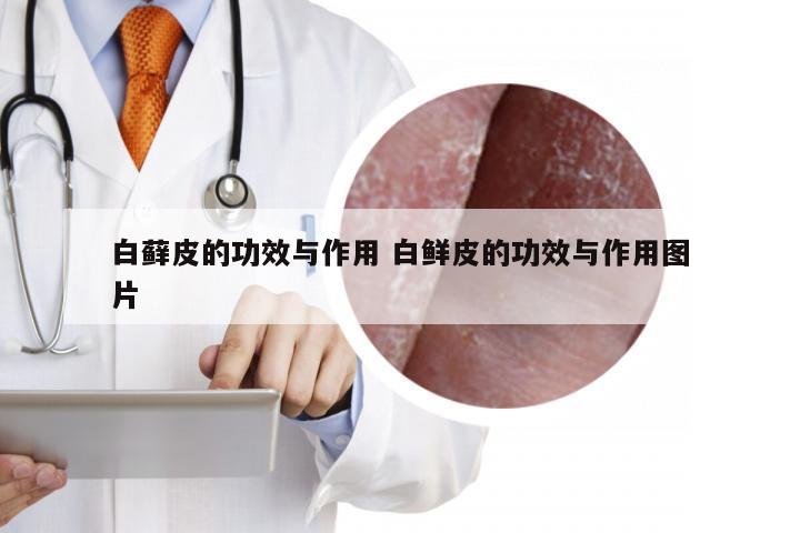 白藓皮的功效与作用 白鲜皮的功效与作用图片