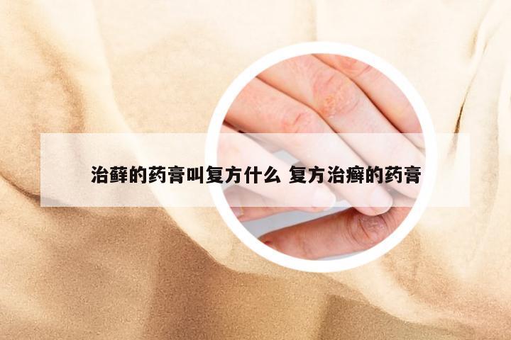 治藓的药膏叫复方什么 复方治癣的药膏