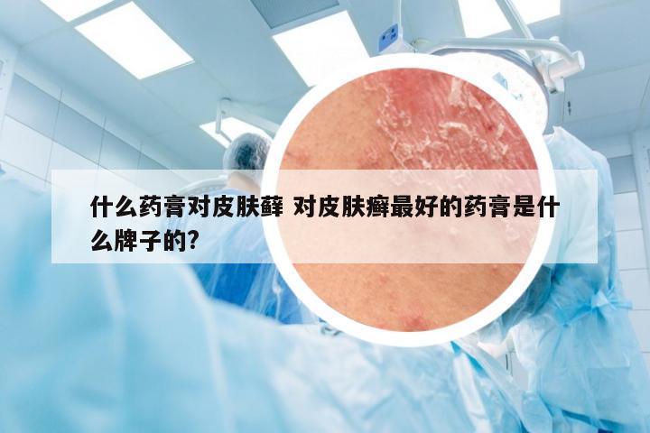 什么药膏对皮肤藓 对皮肤癣最好的药膏是什么牌子的?