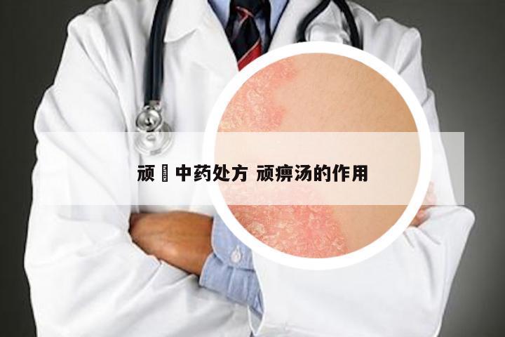 顽廯中药处方 顽痹汤的作用