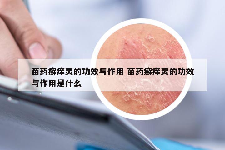 苗药癣痒灵的功效与作用 苗药癣痒灵的功效与作用是什么