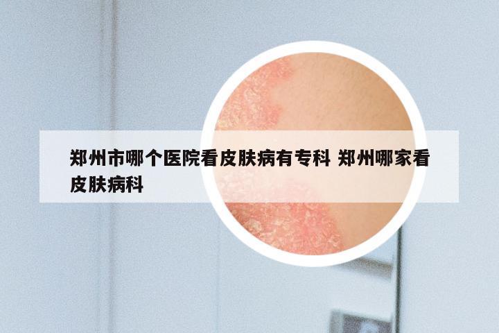 郑州市哪个医院看皮肤病有专科 郑州哪家看皮肤病科