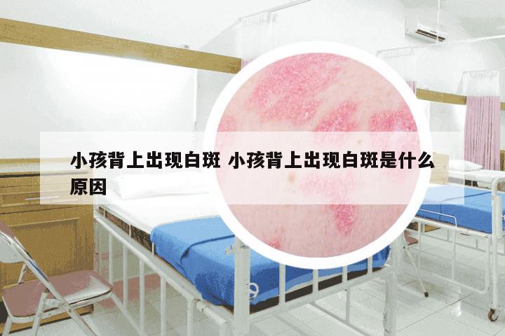 小孩背上出现白斑 小孩背上出现白斑是什么原因