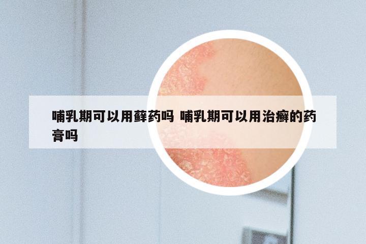 哺乳期可以用藓药吗 哺乳期可以用治癣的药膏吗