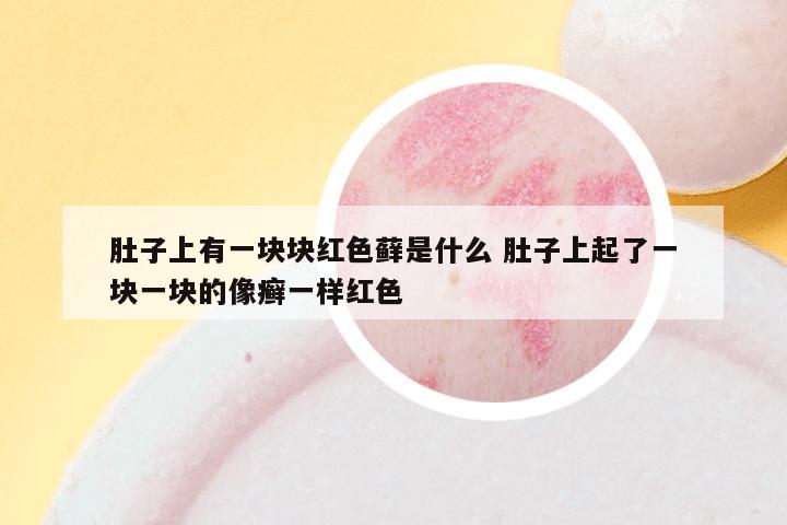肚子上有一块块红色藓是什么 肚子上起了一块一块的像癣一样红色