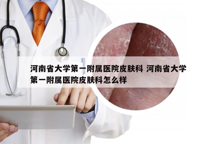 河南省大学第一附属医院皮肤科 河南省大学第一附属医院皮肤科怎么样