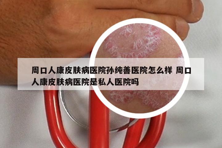 周口人康皮肤病医院孙纯善医院怎么样 周口人康皮肤病医院是私人医院吗