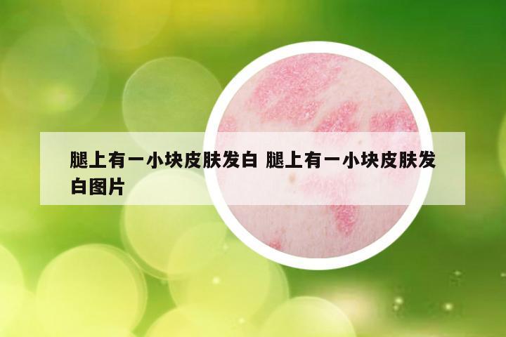 腿上有一小块皮肤发白 腿上有一小块皮肤发白图片