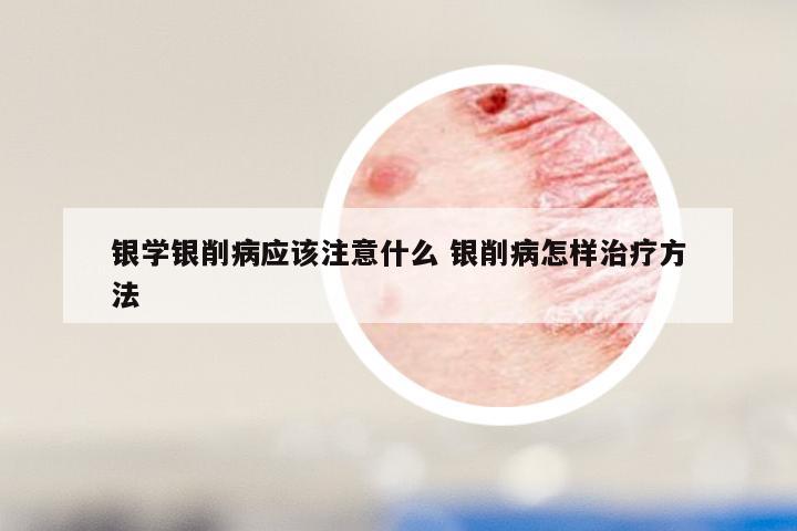 银学银削病应该注意什么 银削病怎样治疗方法