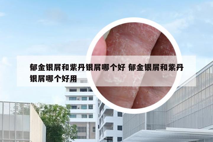 郁金银屑和紫丹银屑哪个好 郁金银屑和紫丹银屑哪个好用