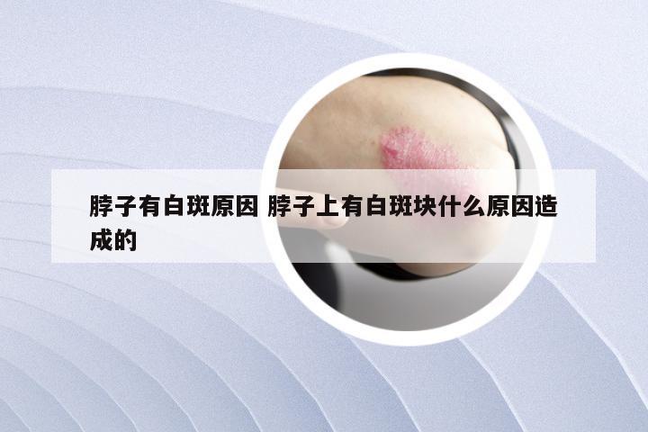 脖子有白斑原因 脖子上有白斑块什么原因造成的