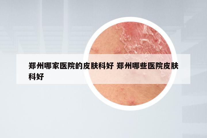 郑州哪家医院的皮肤科好 郑州哪些医院皮肤科好