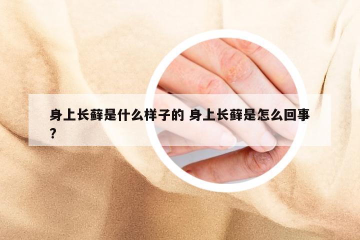 身上长藓是什么样子的 身上长藓是怎么回事?