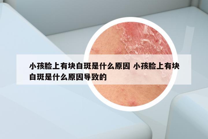 小孩脸上有块白斑是什么原因 小孩脸上有块白斑是什么原因导致的