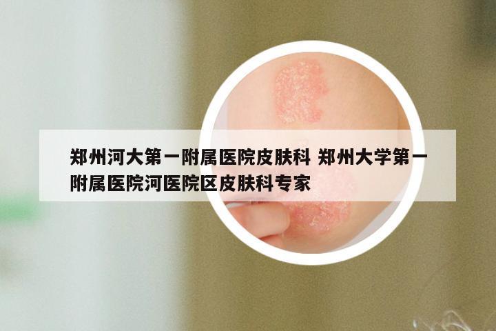 郑州河大第一附属医院皮肤科 郑州大学第一附属医院河医院区皮肤科专家