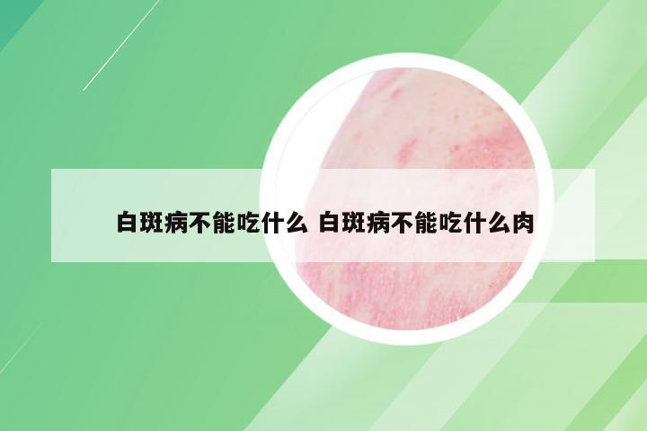 白斑病不能吃什么 白斑病不能吃什么肉