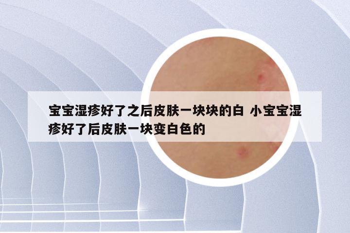 宝宝湿疹好了之后皮肤一块块的白 小宝宝湿疹好了后皮肤一块变白色的