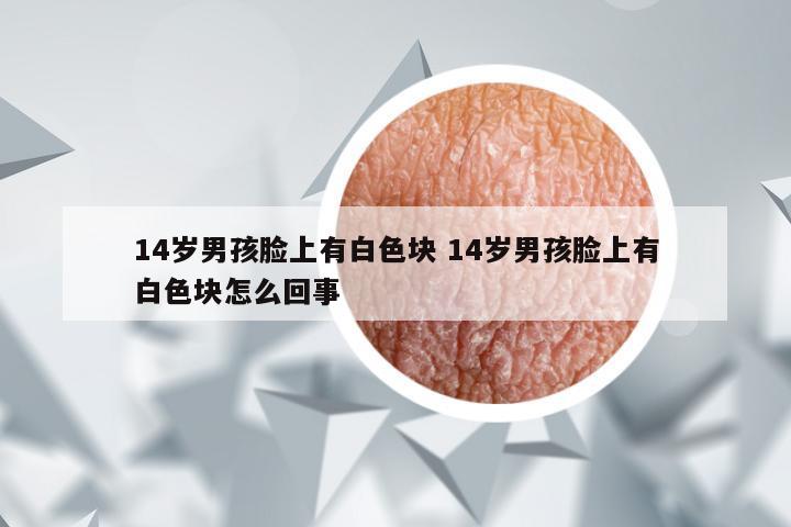 14岁男孩脸上有白色块 14岁男孩脸上有白色块怎么回事