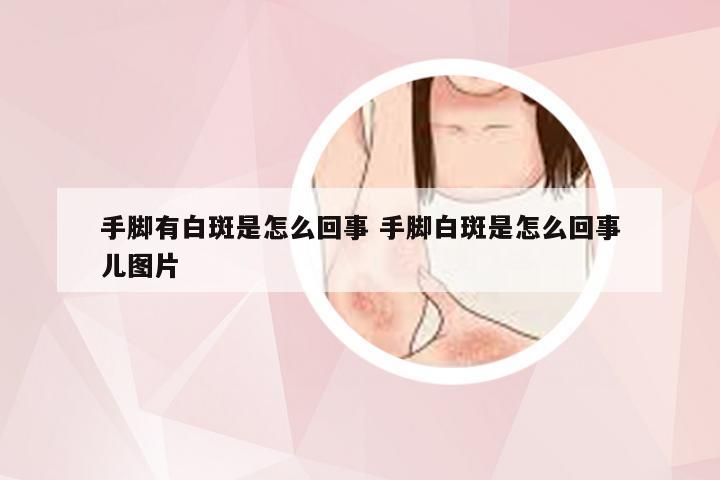 手脚有白斑是怎么回事 手脚白斑是怎么回事儿图片