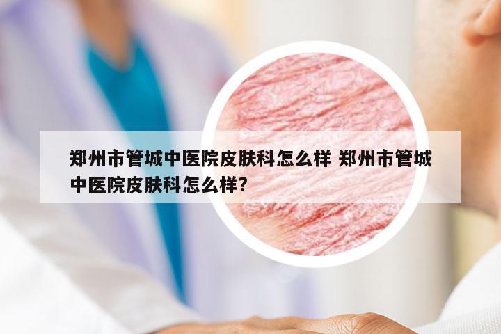 郑州市管城中医院皮肤科怎么样 郑州市管城中医院皮肤科怎么样?