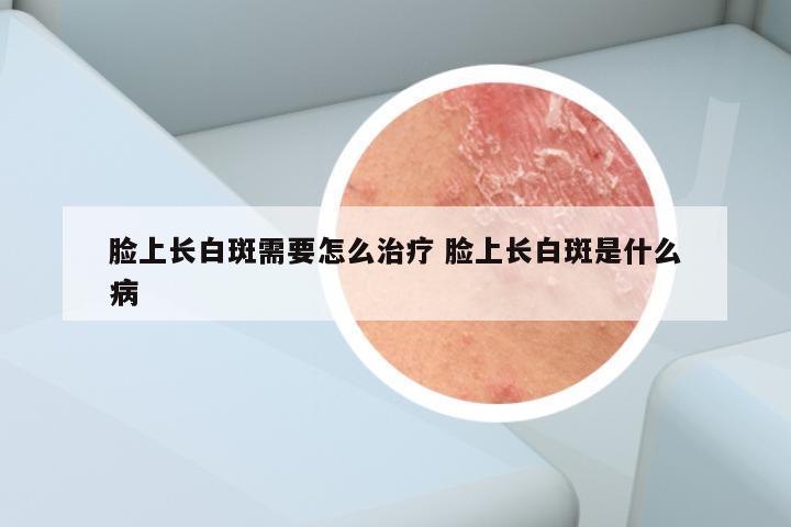 脸上长白斑需要怎么治疗 脸上长白斑是什么病