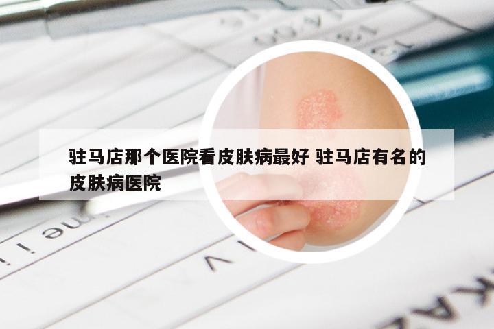 驻马店那个医院看皮肤病最好 驻马店有名的皮肤病医院