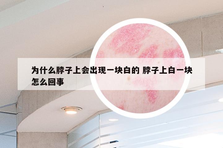 为什么脖子上会出现一块白的 脖子上白一块怎么回事