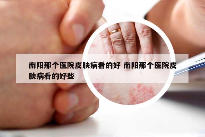 南阳那个医院皮肤病看的好 南阳那个医院皮肤病看的好些