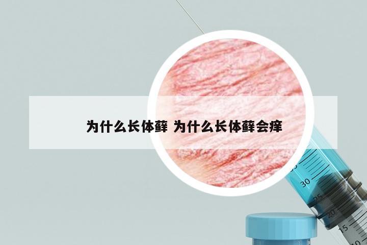为什么长体藓 为什么长体藓会痒