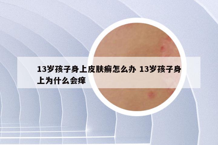 13岁孩子身上皮肤癣怎么办 13岁孩子身上为什么会痒