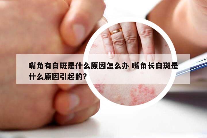 嘴角有白斑是什么原因怎么办 嘴角长白斑是什么原因引起的?