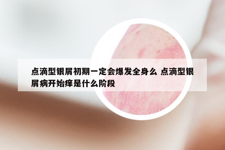 点滴型银屑初期一定会爆发全身么 点滴型银屑病开始痒是什么阶段