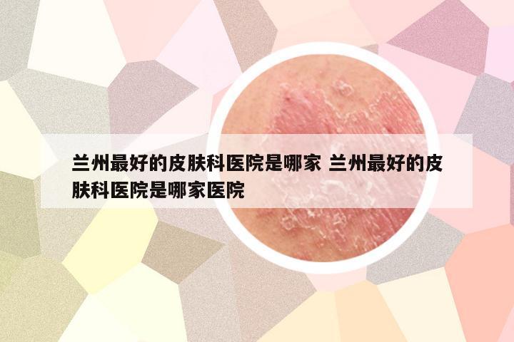兰州最好的皮肤科医院是哪家 兰州最好的皮肤科医院是哪家医院