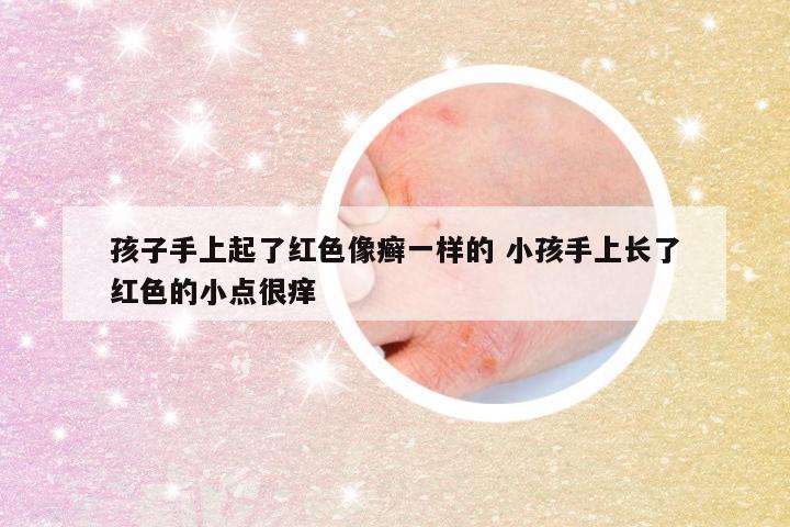 孩子手上起了红色像癣一样的 小孩手上长了红色的小点很痒