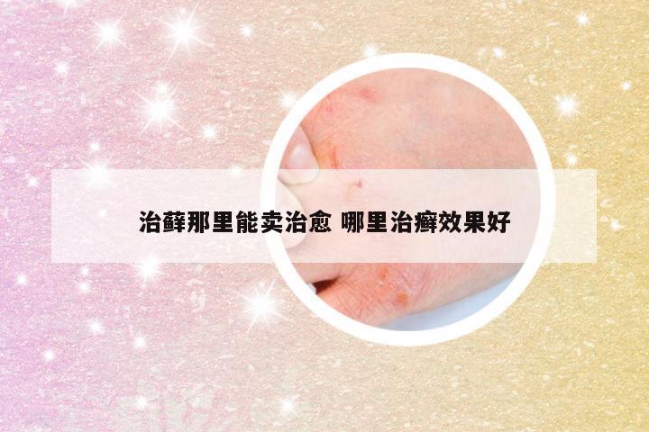 治藓那里能卖治愈 哪里治癣效果好