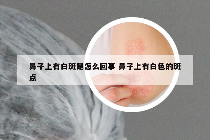 鼻子上有白斑是怎么回事 鼻子上有白色的斑点